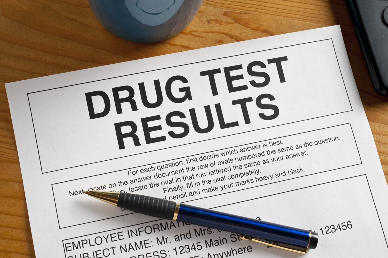 Does CBD Show Up On Drug Test